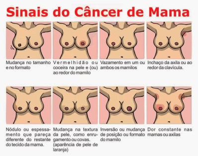 autoexame mama